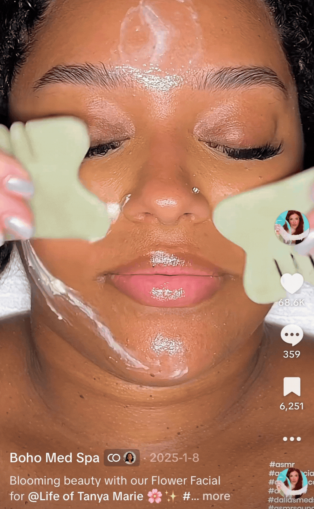 hydrafacial gif