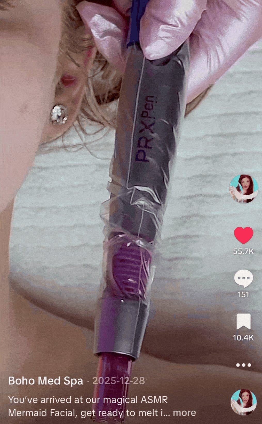resurfx fractional laser gif for customers