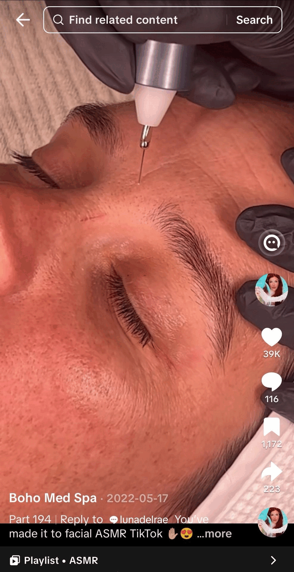 plasma skin tightening