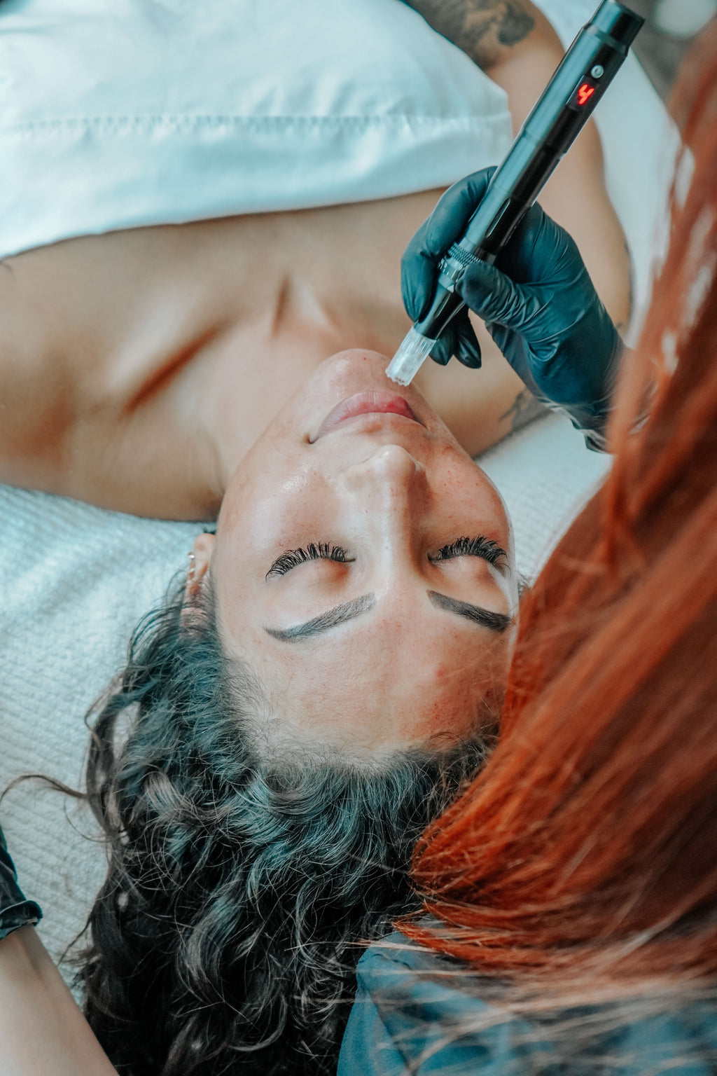 Boho’s March Madness Microneedling Special