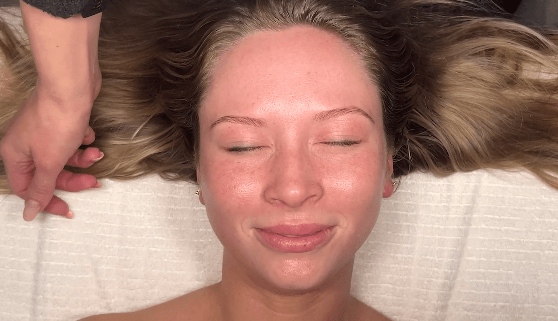 SkinBetter Science Peel 
