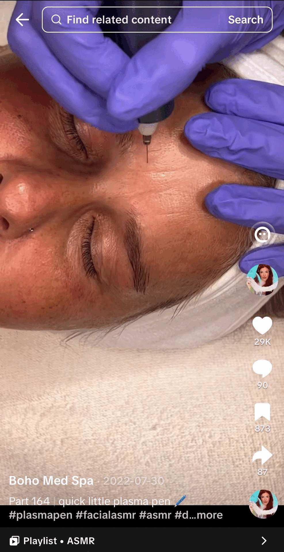 plasma skin tightening