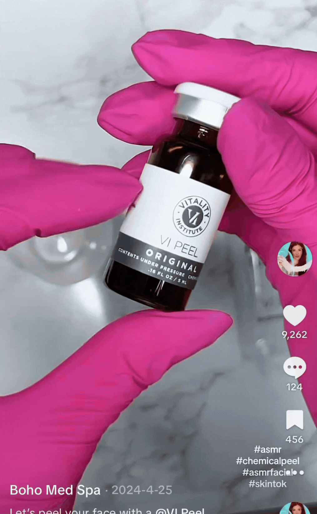 Chemical peel gif