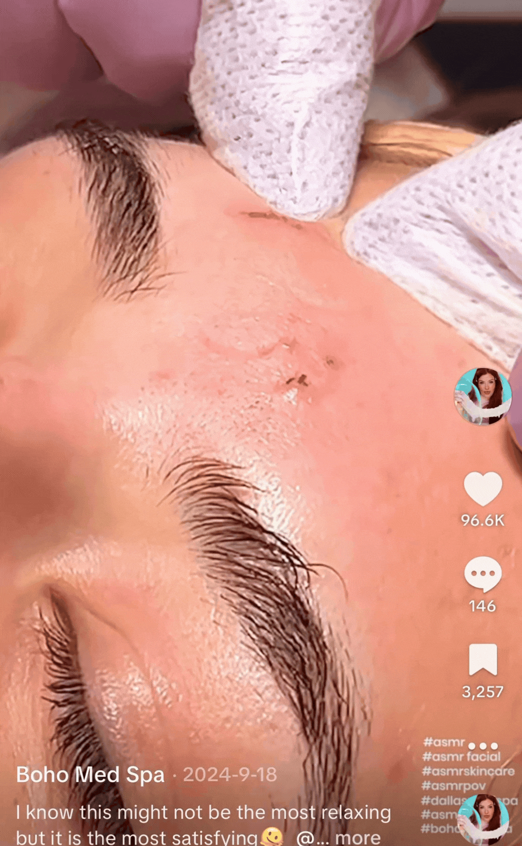 Dermaplaning GIF