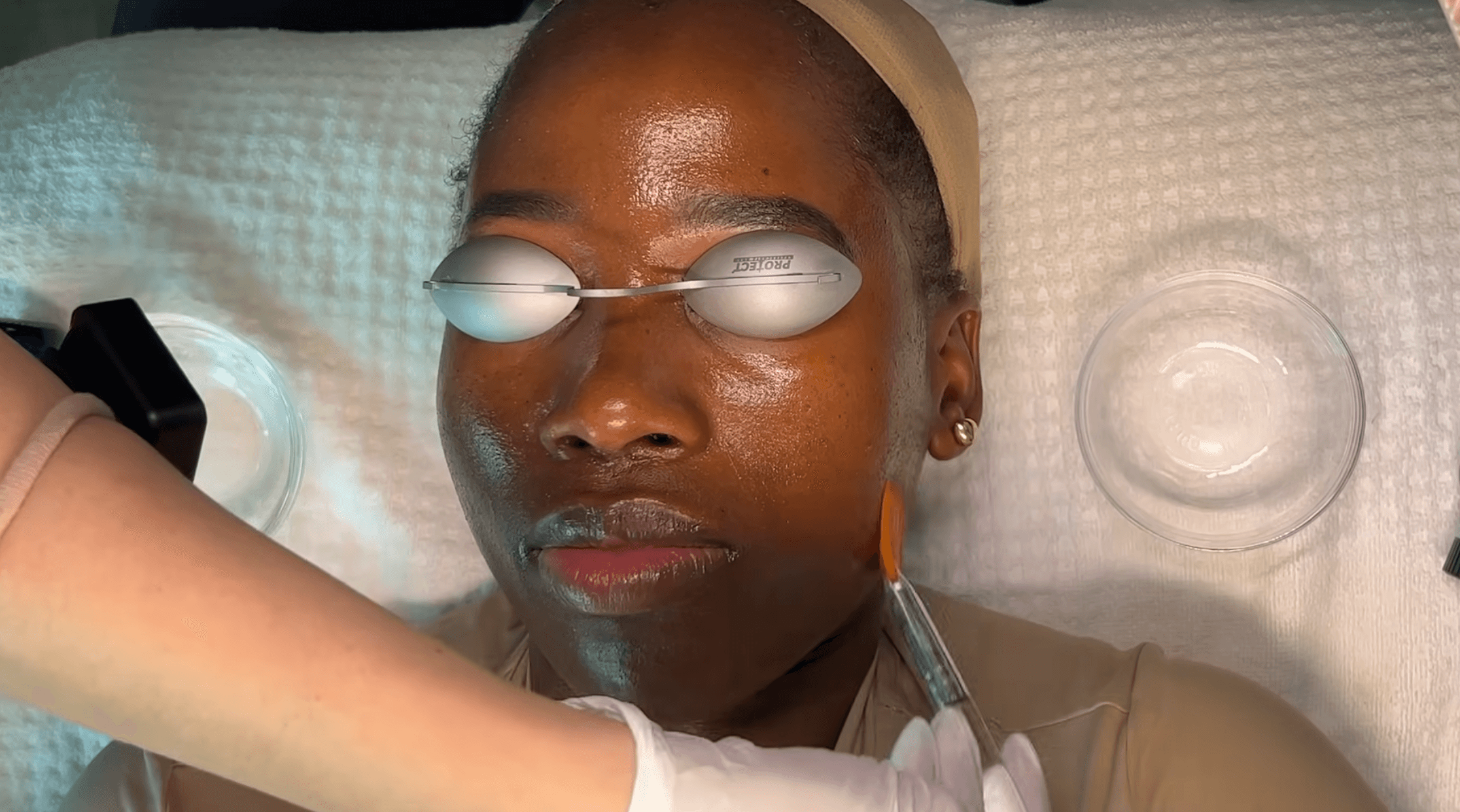 Banner - Plasma Skin Tightening