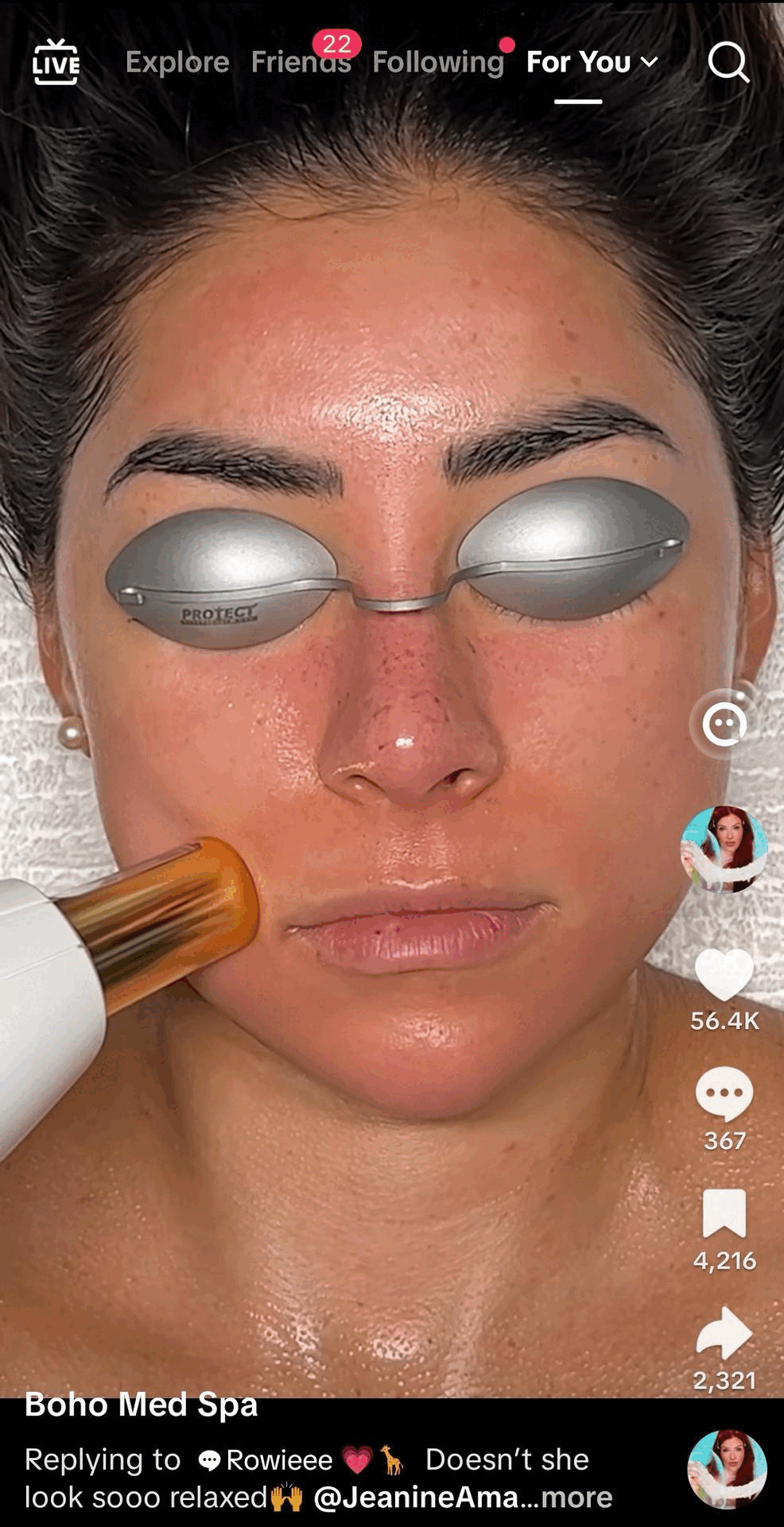 resurfx fractional laser gif for customers