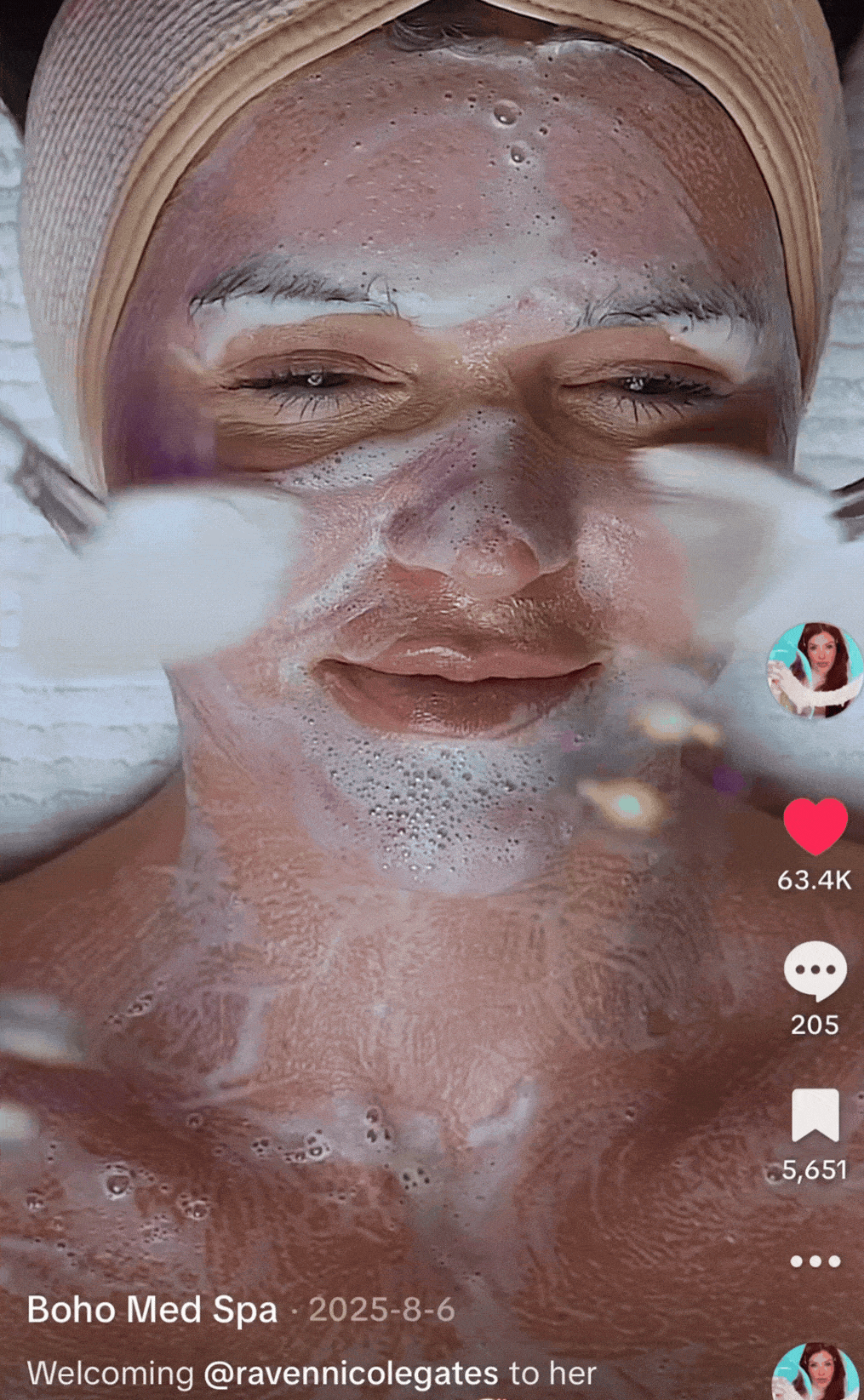ipl photofacial gif