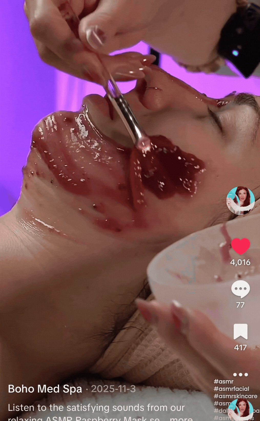 hydrafacial gif