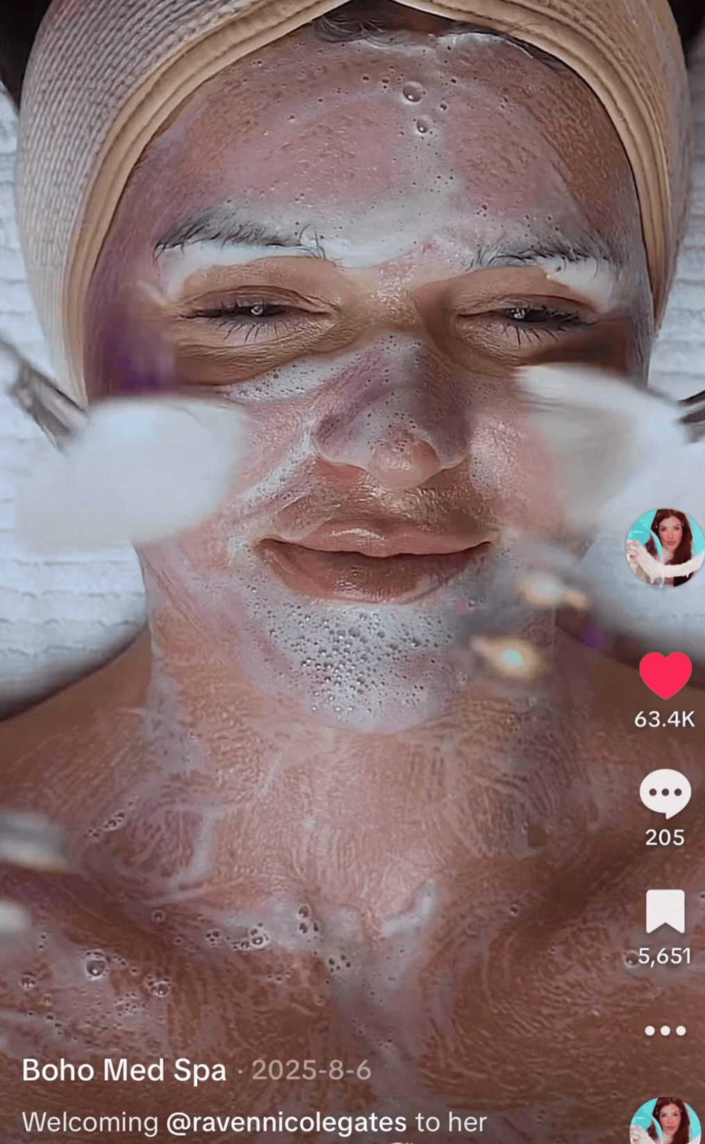 ipl photofacial gif