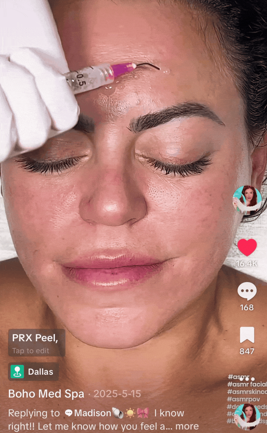 resurfx fractional laser gif for customers