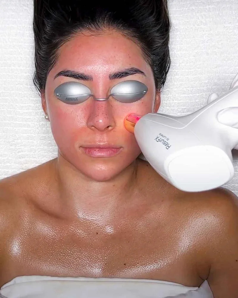 A laser handpiece at a guest's cheek, her eyes covered with protective eyewear