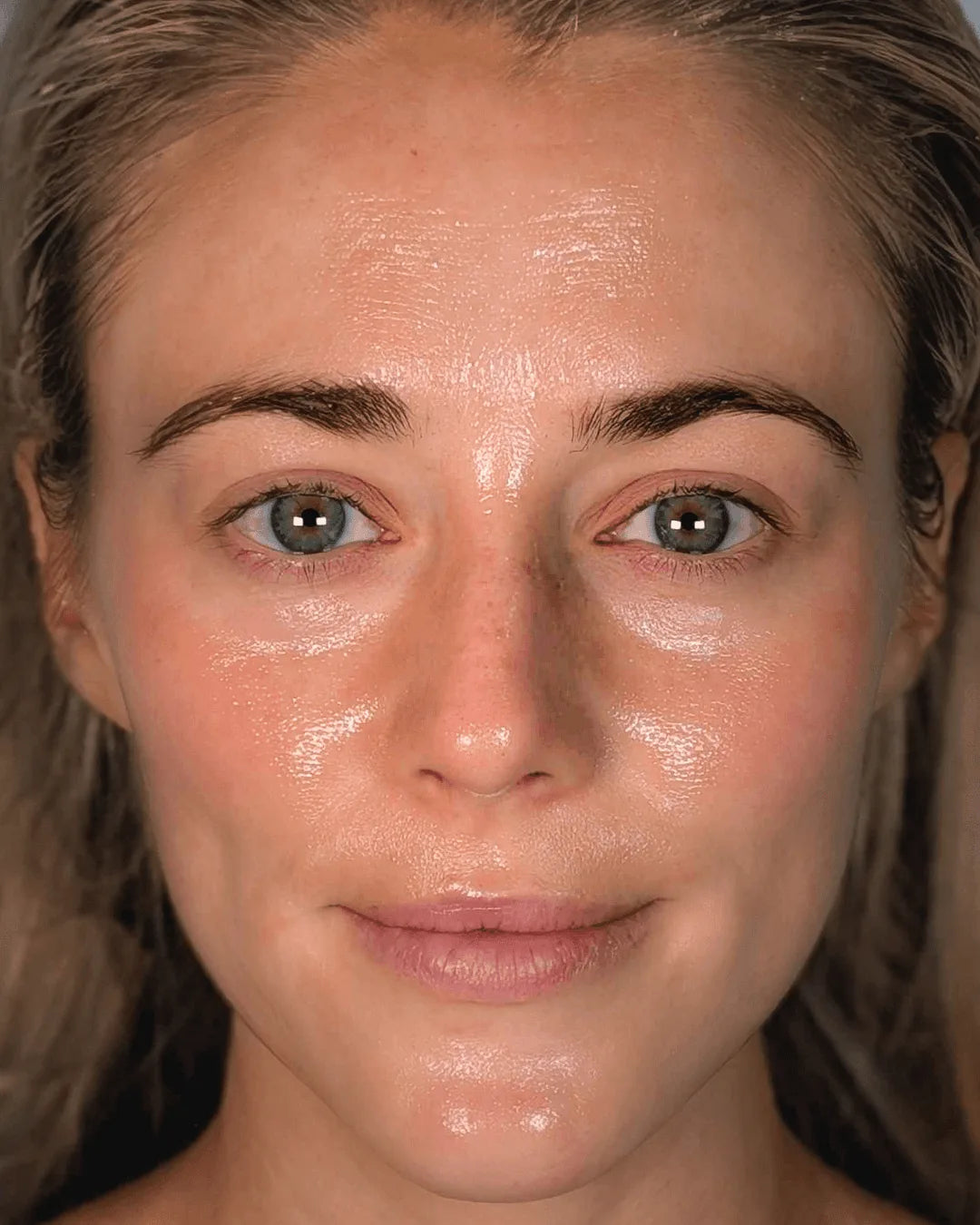 After: the same guest, same framing, following a facial